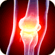 Joint Pain